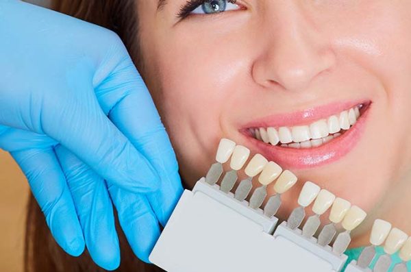 dentist compares dental veneers to natural teeth