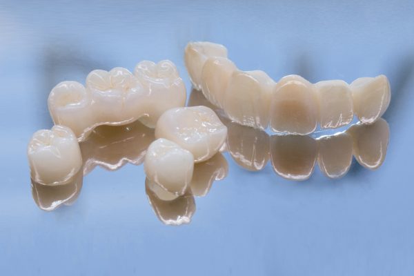 dental bridges and crowns